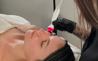 Aquapure en Valencia: La innovación en limpieza y revitalización facial