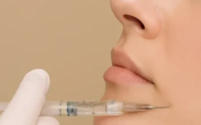 Neuromoduladores en Málaga: Precisión y resultados naturales en medicina estética