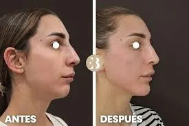 Precisión y armonía facial: tratamientos personalizados para realzar tu expresión natural